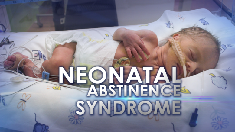 Drug Addicted Babies – Neonatal Abstinence Syndrome